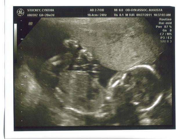 Wordless Wednesday: Abigail Grace!